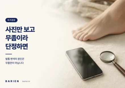 리넨 위에 놓인 스마트폰과 돋보기, 흐릿하게 보이는 맨발 - 발톱 사진만으로 무좀을 자가진단하는 위험을 나타낸 이미지