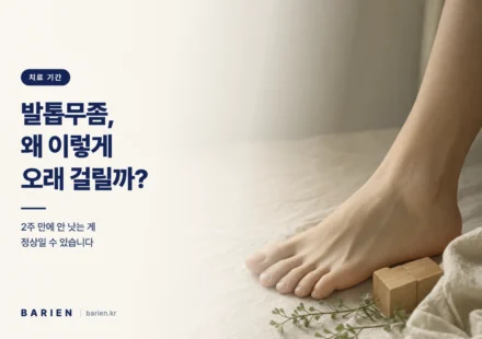 크림색 리넨 위에 놓인 맨발과 나무 달력 블록 - 발톱무좀 치료가 오래 걸리는 이유를 설명하는 이미지