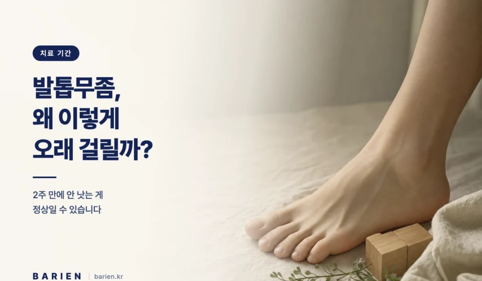크림색 리넨 위에 놓인 맨발과 나무 달력 블록 - 발톱무좀 치료가 오래 걸리는 이유를 설명하는 이미지