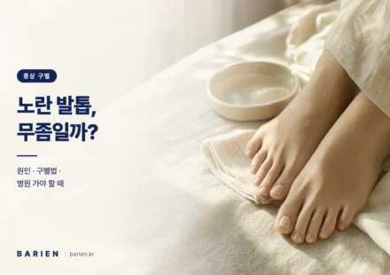 창가 자연광 아래 크림색 리넨 위에 놓인 맨발 발톱 클로즈업 - 노랗게 변한 발톱의 원인과 구별법을 다루는 이미지